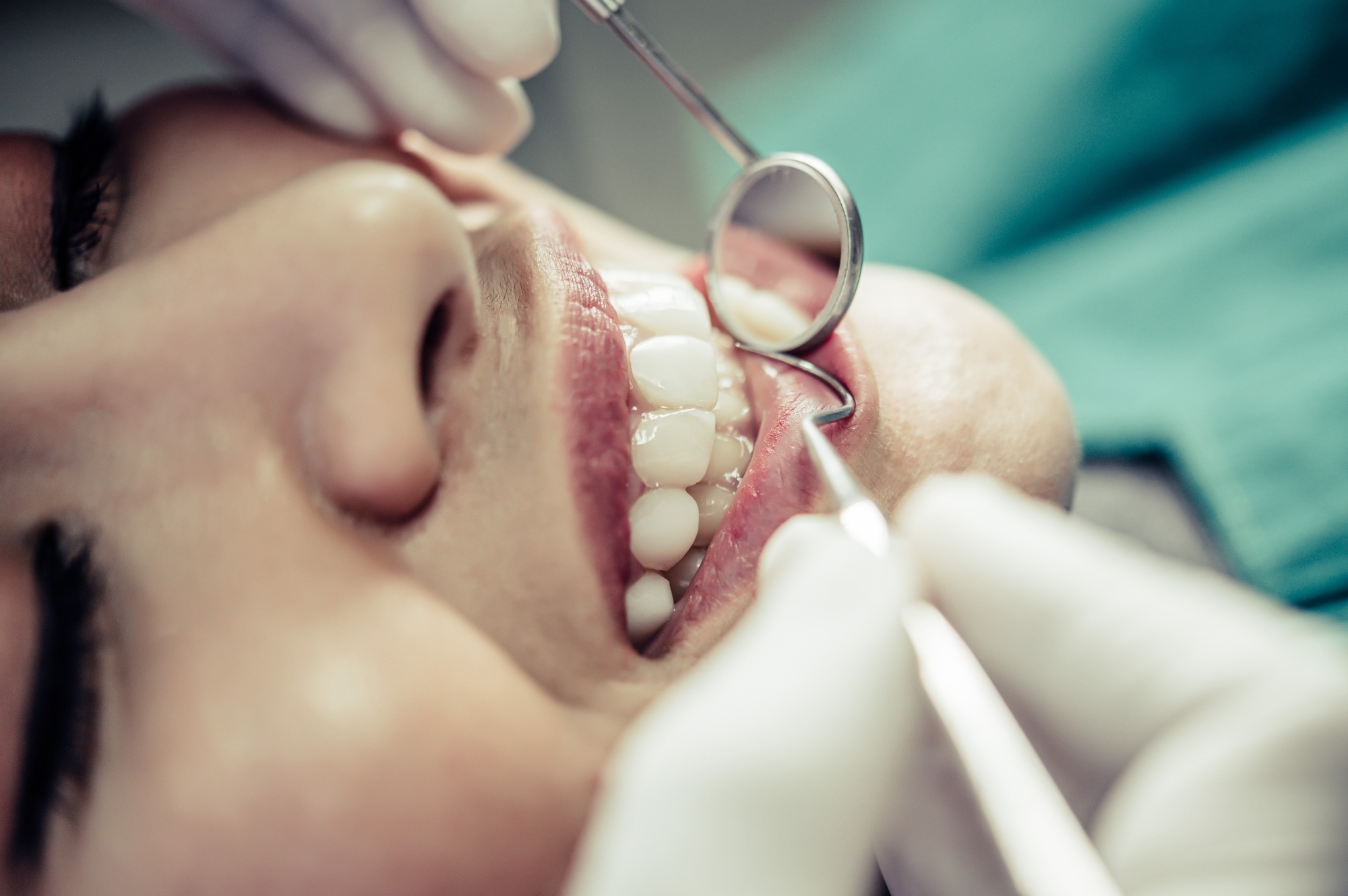 Why You Shouldn’t Delay Getting Dental Implants: The True Cost of Putting It Off