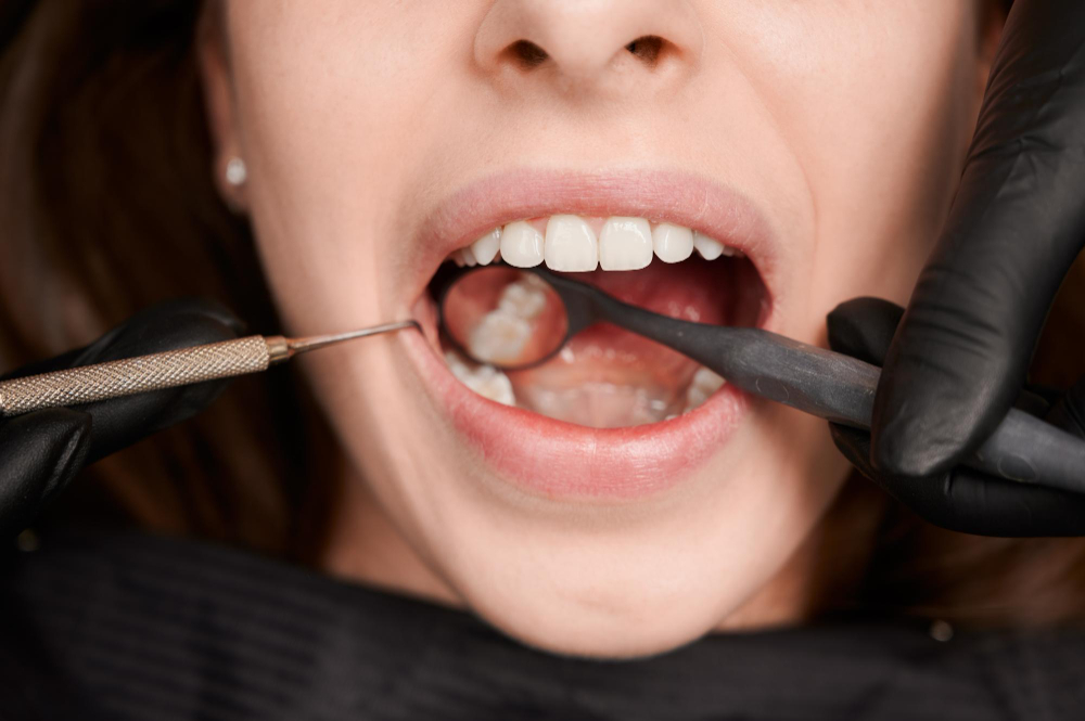 An In-Depth Guide to Restorative Dentistry: Treatments, Techniques, and Advancements