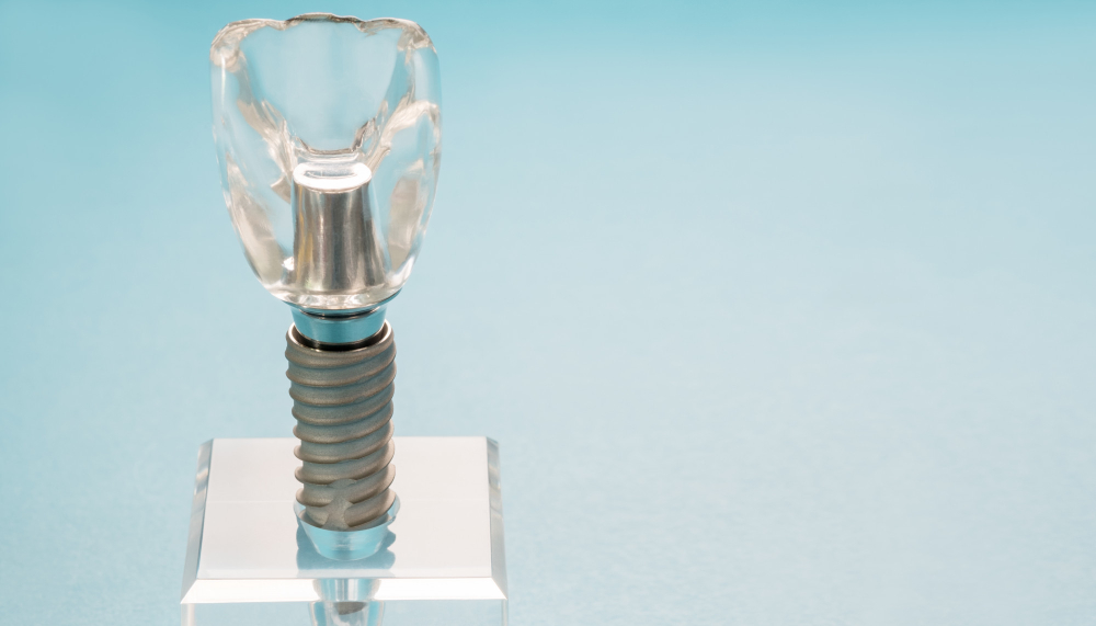 The Benefits of Dental Implants Over Traditional Dentures: A Comprehensive Comparison