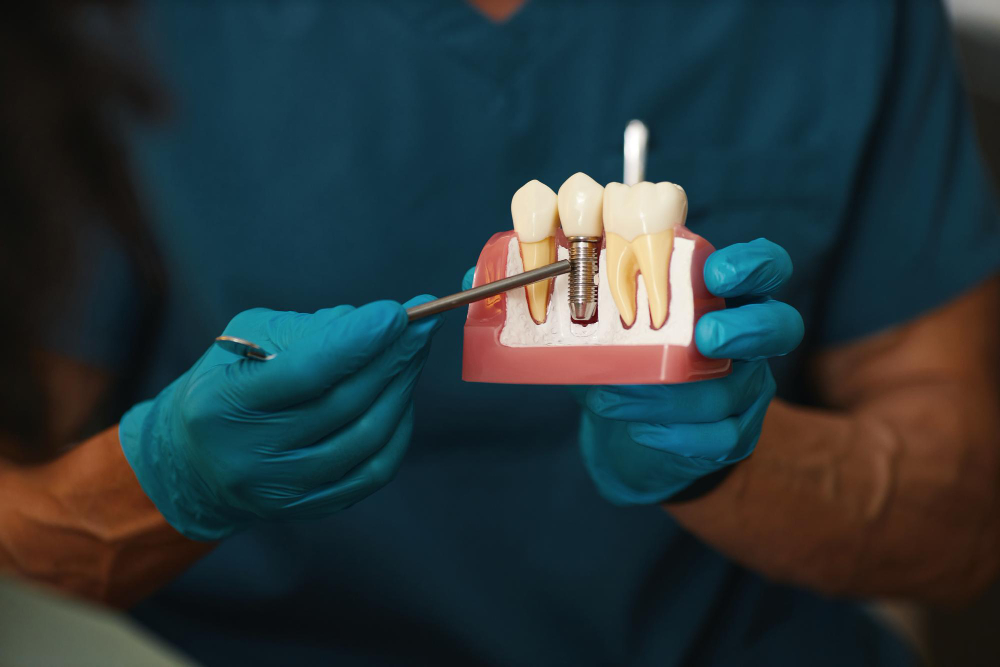 The Role of Bone Grafting in Dental Implantology